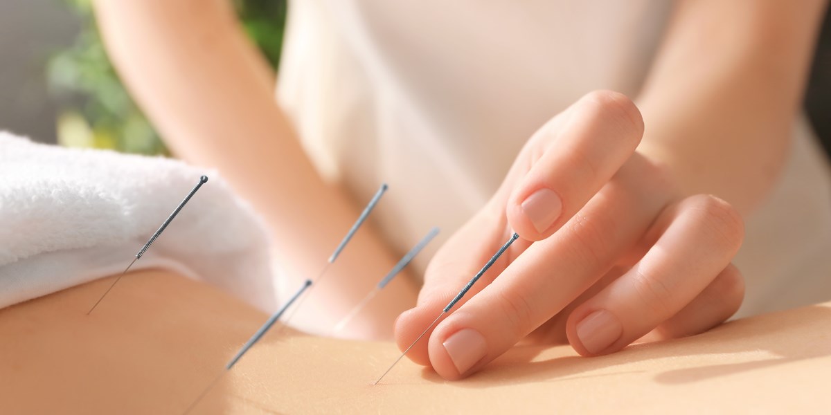 Improving IVF Success With Acupuncture